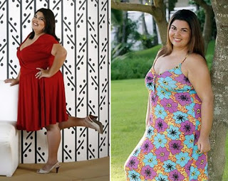 Fabiana Karla antes e depois da redução de estomago