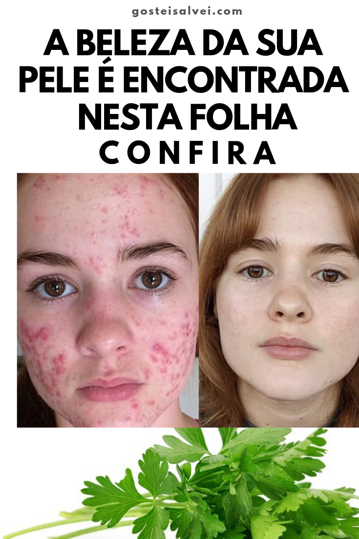 You are currently viewing A Beleza Da Sua Pele é Encontrada Nesta Folha – Confira