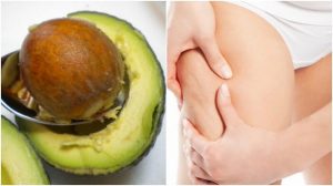Read more about the article Sementes De Abacate Podem Te Ajudar a Diminuir 90% Da Celulite Veja Como