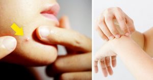 Read more about the article 9 Truques para se livrar dos problemas mais comuns do dia a dia