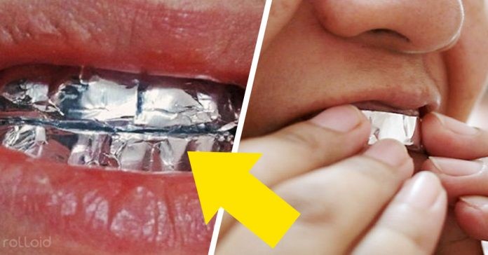 Você está visualizando atualmente Descubra o que acontece quando você coloca papel alumínio nos seus dentes