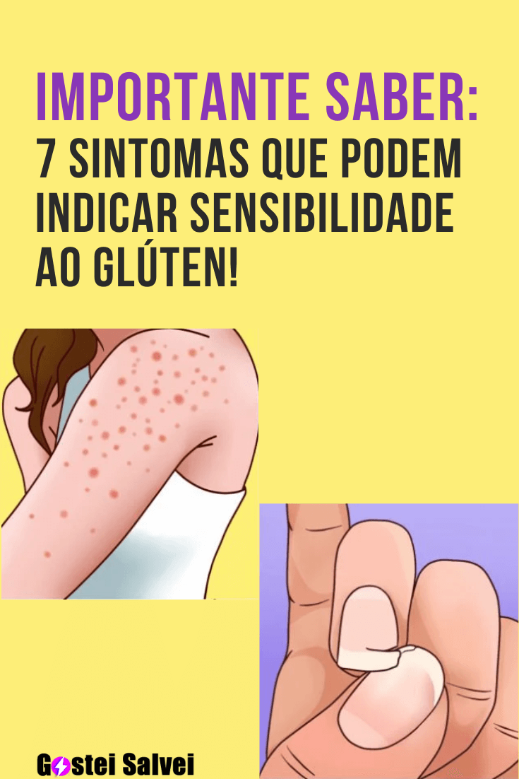 You are currently viewing <strong>Importante saber: 7 sintomas que podem indicar sensibilidade ao glúten!</strong>